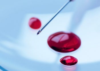 Alzheimer : une goutte de sang pourrait tout changer dans le diagnostic !