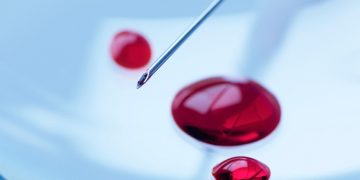 Alzheimer : une goutte de sang pourrait tout changer dans le diagnostic !