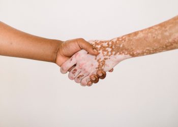 Enfin une solution remboursée pour les personnes atteintes de vitiligo