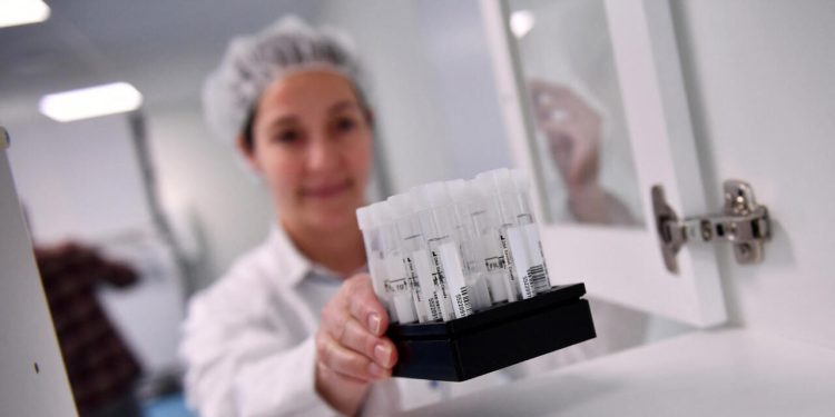 L’Endométriose enfin démasquée ? La révolution du test salivaire à portée de toutes