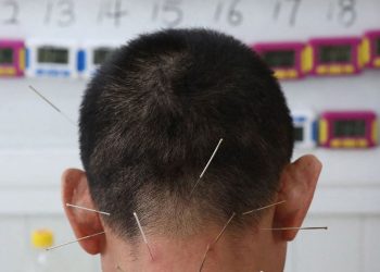 Les acupuncteurs répliquent avec véhémence aux critiques de Vandenbroucke sur leur pratique – RTBF Actus